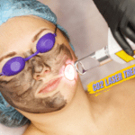 CO2 laser recovery